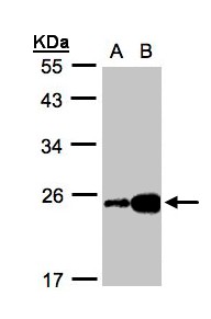 I-BABP / FABP6 Antibody - Sample (30 ug whole cell lysate). A: HeLa S3, B: Hep G2 . 12% SDS PAGE. I-BABP / FABP6 antibody diluted at 1:1000