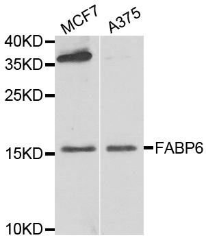 I-BABP / FABP6 Antibody - Western blot analysis of extracts of various cell lines.