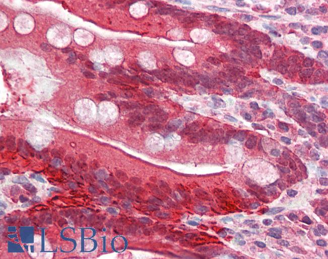 I-FABP / FABP2 Antibody - Anti-FABP2 antibody IHC of human small intestine. Immunohistochemistry of formalin-fixed, paraffin-embedded tissue after heat-induced antigen retrieval. Antibody concentration 5 ug/ml.