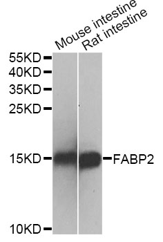 I-FABP / FABP2 Antibody - Western blot analysis of extracts of various cell lines, using FABP2 antibody at 1:500 dilution. The secondary antibody used was an HRP Goat Anti-Rabbit IgG (H+L) at 1:10000 dilution. Lysates were loaded 25ug per lane and 3% nonfat dry milk in TBST was used for blocking. An ECL Kit was used for detection and the exposure time was 1s.