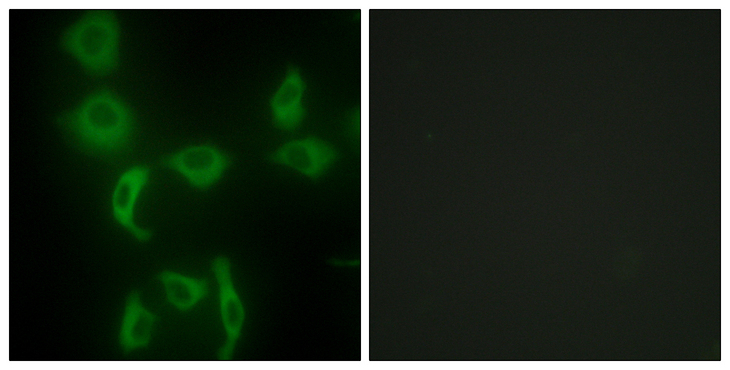 IARS2 Antibody - Immunofluorescence analysis of HepG2 cells, using IARS2 Antibody. The picture on the right is blocked with the synthesized peptide.
