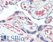 IBSP / Bone Sialoprotein Antibody - Human Placenta: Formalin-Fixed, Paraffin-Embedded (FFPE), at a concentration of 10 ug/ml
