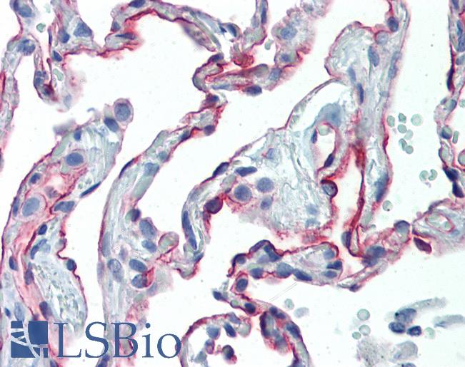 ICAM-1 / CD54 Antibody - Anti-ICAM-1 antibody IHC of human lung. Immunohistochemistry of formalin-fixed, paraffin-embedded tissue after heat-induced antigen retrieval. Antibody concentration 10 ug/ml.