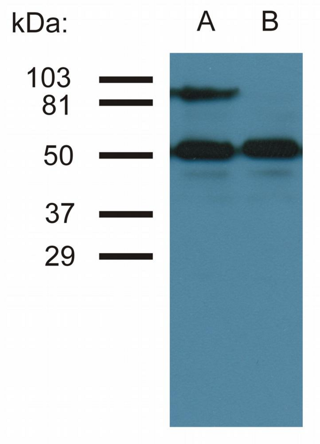 ICAM-1 / CD54 Antibody - Western blottin analysis of CD54 expression in TNF-alpha activated (A) and nonactivated (B) HUVEC cells by antibody MEM-111. Lower bands represent tubulin as a loading control.