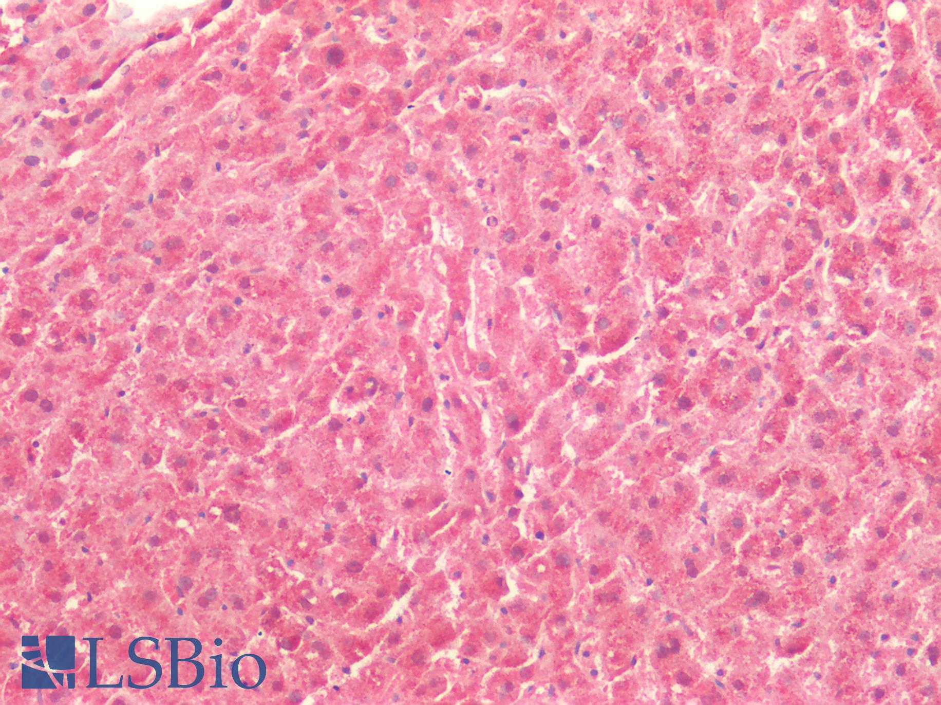 ICAM-1 / CD54 Antibody - Human Liver: Formalin-Fixed, Paraffin-Embedded (FFPE)