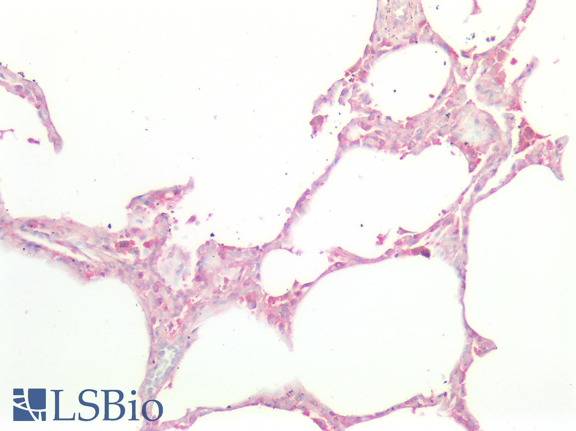ICAM-1 / CD54 Antibody - Human Lung: Formalin-Fixed, Paraffin-Embedded (FFPE)