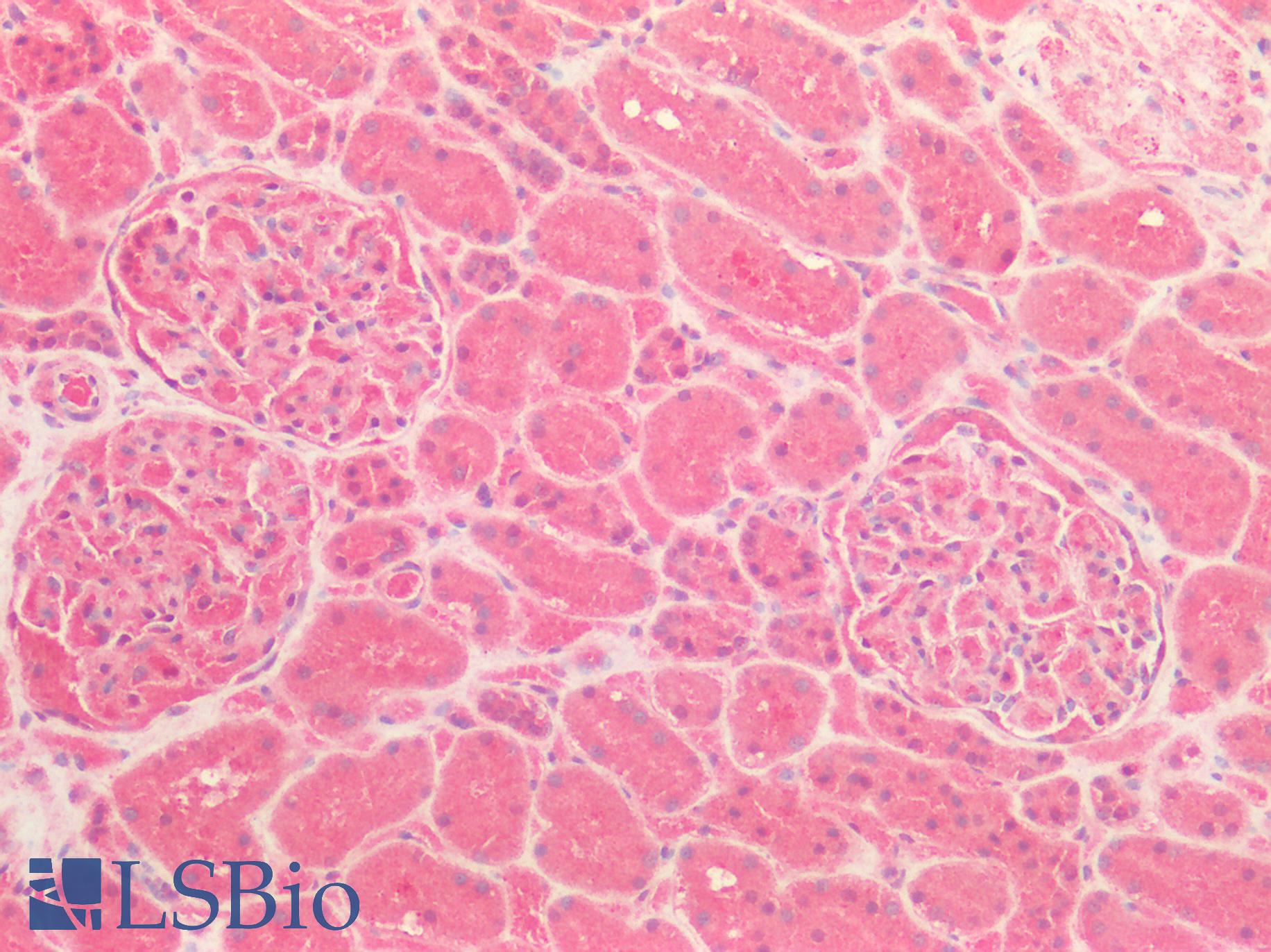 ICAM-1 / CD54 Antibody - Human Kidney: Formalin-Fixed, Paraffin-Embedded (FFPE)