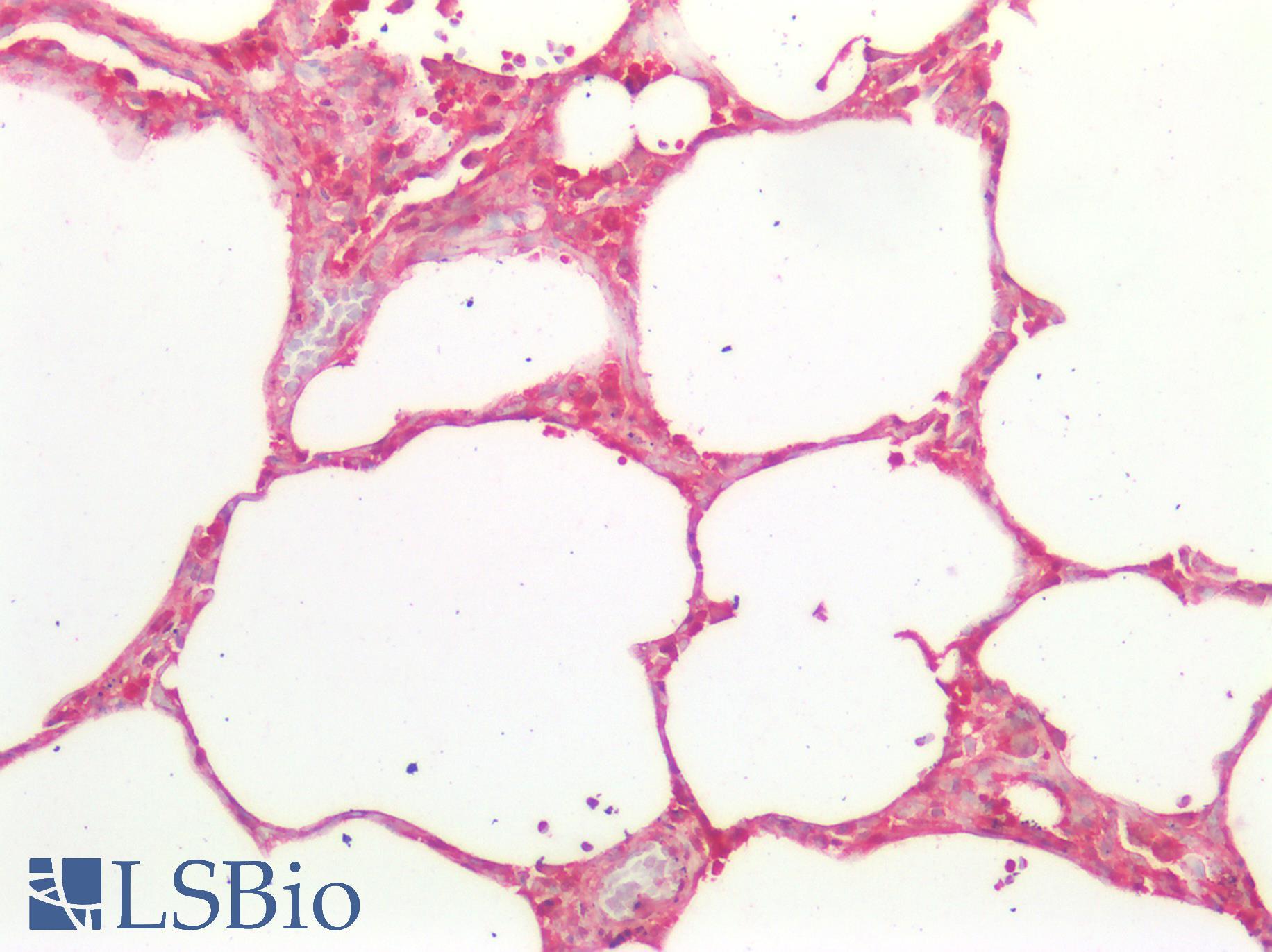 ICAM-1 / CD54 Antibody - Human Lung: Formalin-Fixed, Paraffin-Embedded (FFPE)