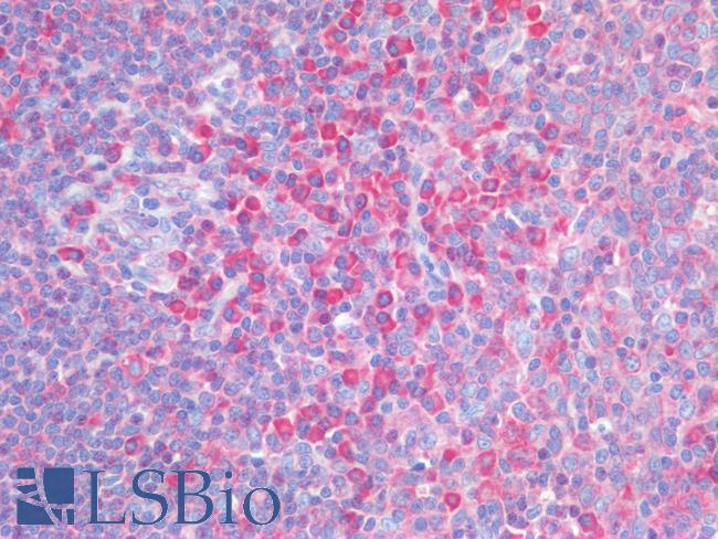 ICOS / CD278 Antibody - Human Tonsil: Formalin-Fixed, Paraffin-Embedded (FFPE)