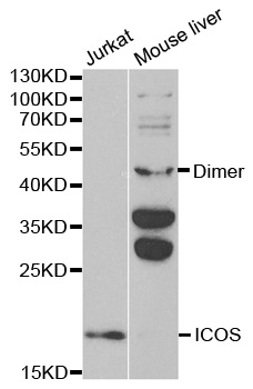 ICOS / CD278 Antibody - Western blot analysis of extracts of various cell lines, using ICOS antibody.