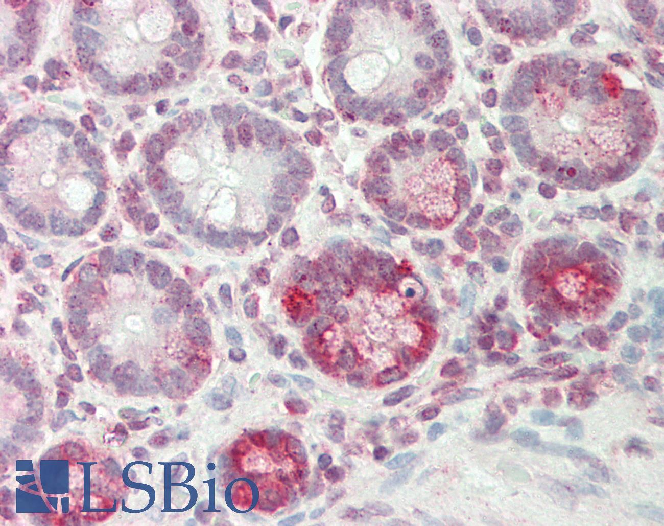 ICOS / CD278 Antibody - Human Small Intestine: Formalin-Fixed, Paraffin-Embedded (FFPE)