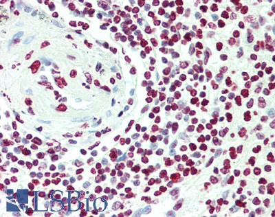 ICSBP / IRF8 Antibody - Human Spleen: Formalin-Fixed, Paraffin-Embedded (FFPE), at a concentration of 5 ug/ml.