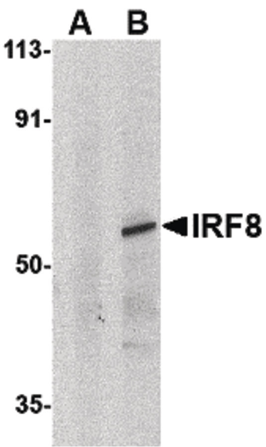 ICSBP / IRF8 Antibody - Western blot of IRF8 in human thymus tissue lysate with IRF8 antibody at 1ug/ml in (A) the presence and (B) absence of blocking peptide.
