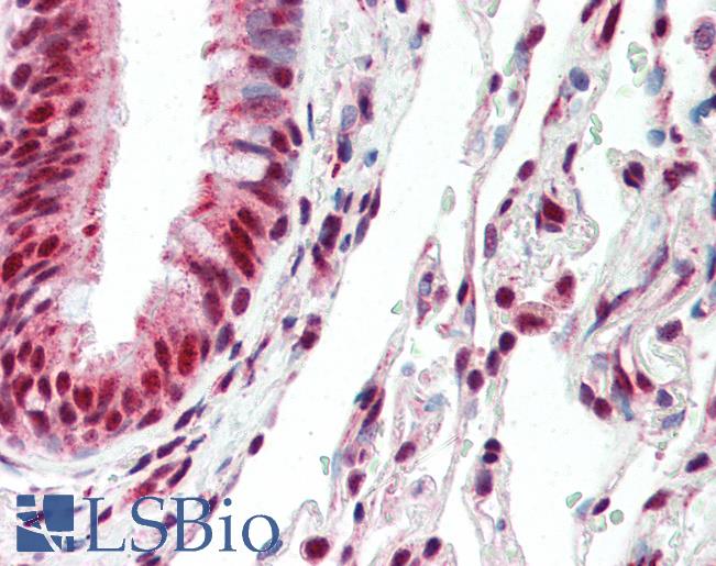 ID3 Antibody - Anti-ID3 antibody IHC of human lung. Immunohistochemistry of formalin-fixed, paraffin-embedded tissue after heat-induced antigen retrieval. Antibody concentration 10 ug/ml.