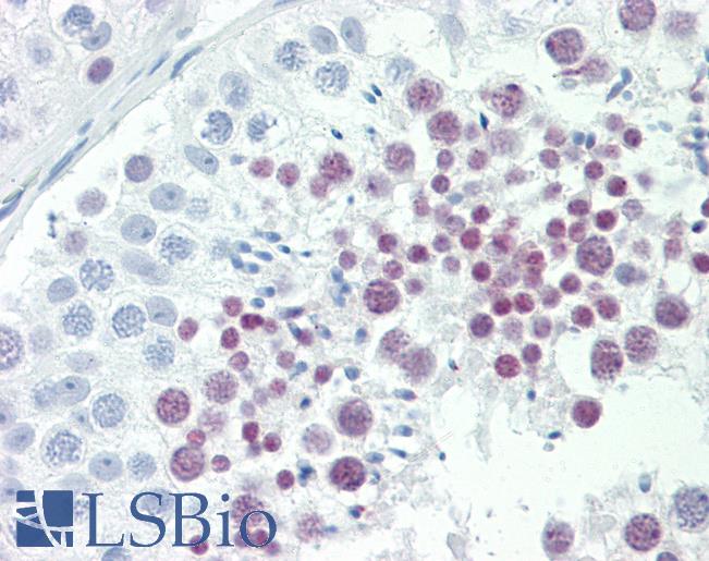 ID4 Antibody - Anti-ID4 antibody IHC staining of human testis. Immunohistochemistry of formalin-fixed, paraffin-embedded tissue after heat-induced antigen retrieval. Antibody dilution 1:100.