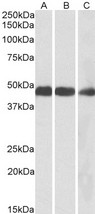 IDH2 Antibody - Goat Anti-IDH2 Antibody (0.1µg/ml) staining of Mouse (A), Rat (B) and Pig (C) Heart lysates (35µg protein in RIPA buffer). Detected by chemiluminescencence.