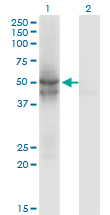 IDH2 Antibody - Western blot of IDH2 expression in transfected 293T cell line by IDH2 monoclonal antibody clone 5F11.