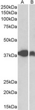 IDH3A Antibody - Goat Anti-IDH3A Antibody (0.3µg/ml) staining of Pig Spleen (A) and Pig Skeletal Muscle (B) lysates (35µg protein in RIPA buffer). Detected by chemiluminescencence.
