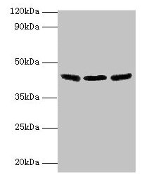 IDH3B Antibody - Western blot All lanes: Isocitrate dehydrogenase [NAD] subunit beta, mitochondrial antibody at 2µg/ml Lane 1: Hela whole cell lysate Lane 2: Mouse kidney tissue Lane 3: Mouse gonad tissue Secondary Goat polyclonal to rabbit IgG at 1/10000 dilution Predicted band size: 43, 42, 26 kDa Observed band size: 43 kDa