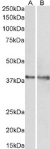 IDH3G Antibody - Goat Anti-IDH3G (aa337-350) Antibody (1µg/ml) staining of Rat (A) and Pig (B) Heart lysate (35µg protein in RIPA buffer). Primary incubation was 1 hour. Detected by chemiluminescencence.