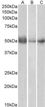 IDO1 / IDO Antibody - IDO1 / IDO antibody (0.5µg/ml) staining of Human Lymph Node (A), Spleen (B) and Placenta (C) lysates (35µg protein in RIPA buffer). Detected by chemiluminescence.