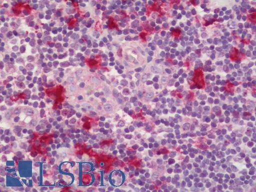 IDO1 / IDO Antibody - Human Tonsil: Formalin-Fixed, Paraffin-Embedded (FFPE).  This image was taken for the unconjugated form of this product. Other forms have not been tested.