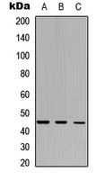 IDO2 / INDOL1 Antibody - Western blot analysis of IDO2 expression in HepG2 (A); Raw264.7 (B); PC12 (C) whole cell lysates.