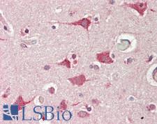 IDS / Iduronate 2 Sulfatase Antibody - Human Brain, Cortex: Formalin-Fixed, Paraffin-Embedded (FFPE)