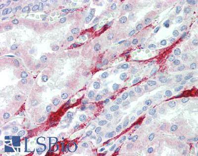 IDUA / MPS1 Antibody - Human Kidney: Formalin-Fixed, Paraffin-Embedded (FFPE), at a concentration of 10 ug/ml. 