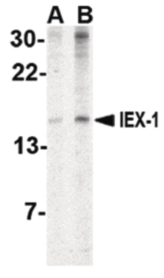 IER3 / IEX-1 Antibody - Western blot of IEX1 in human brain tissue lysate with IEX1 antibody at (A) 2 and (B) 4 ug/ml.