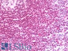 IFI16 Antibody - Human Tonsil: Formalin-Fixed, Paraffin-Embedded (FFPE) 