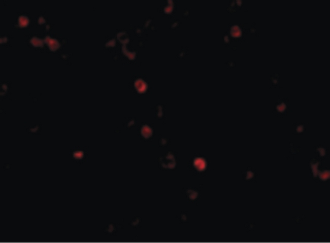IFIH1 / MDA5 Antibody - Immunofluorescence of MDA5 in Human Lymph Node cells with MDA5 antibody at 20 ug/ml.