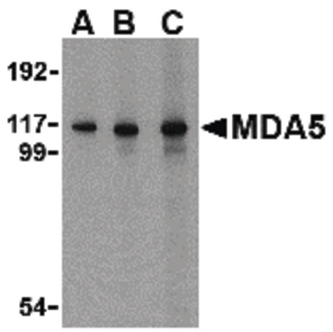 IFIH1 / MDA5 Antibody - Western blot analysis of Anti-MDA5 antibody in Daudi Cell lysate (LS-B2107). Lane 1: 1 µg/ml. Lane 2: 2 µl. Lane 3: 4 µg/ml. Antibody produced a predominant band at ~117kDA in Daudi cell line at all concentrations. 
