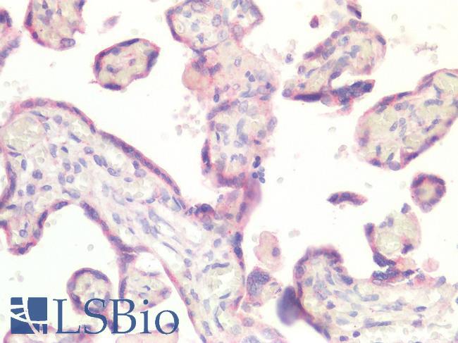 IFIH1 / MDA5 Antibody - Human Placenta: Formalin-Fixed, Paraffin-Embedded (FFPE)