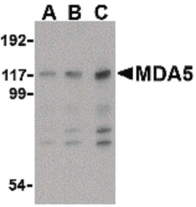 IFIH1 / MDA5 Antibody - Western blot of MDA5 in Daudi cell lysate with MDA5 antibody at (A) 1, (B) 2 and (C) 4 ug/ml.
