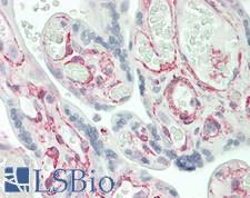 IFITM5 Antibody - Human Placenta: Formalin-Fixed, Paraffin-Embedded (FFPE)