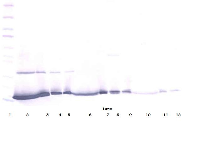 IFN Gamma / Interferon Gamma Antibody - Anti-Human IFN-? Western Blot Reduced