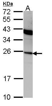 IFNA2 / Interferon Alpha 2 Antibody - Sample (30 ug of whole cell lysate). A: A431 . 12% SDS PAGE. IFNA / Interferon Alpha 2 antibody diluted at 1:1000.