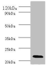 IFNA2 / Interferon Alpha 2 Antibody - Western blot All lanes: Interferon alpha-2 antibody at 2µg/ml + Mouse liver tissue Secondary Goat polyclonal to rabbit IgG at 1/10000 dilution Predicted band size: 22 kDa Observed band size: 22 kDa