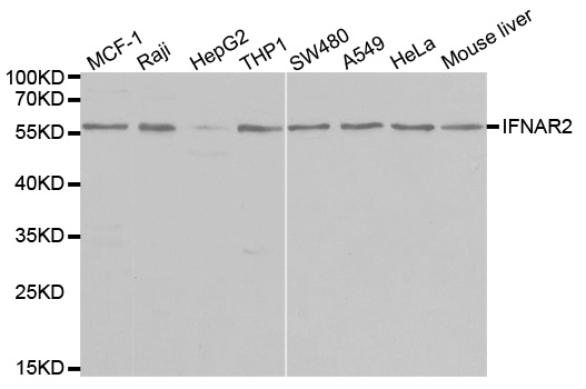 IFNAR2 Antibody - Western blot analysis of extracts of various cell lines, using IFNAR2 antibody at 1:1000 dilution. The secondary antibody used was an HRP Goat Anti-Rabbit IgG (H+L) at 1:10000 dilution. Lysates were loaded 25ug per lane and 3% nonfat dry milk in TBST was used for blocking.