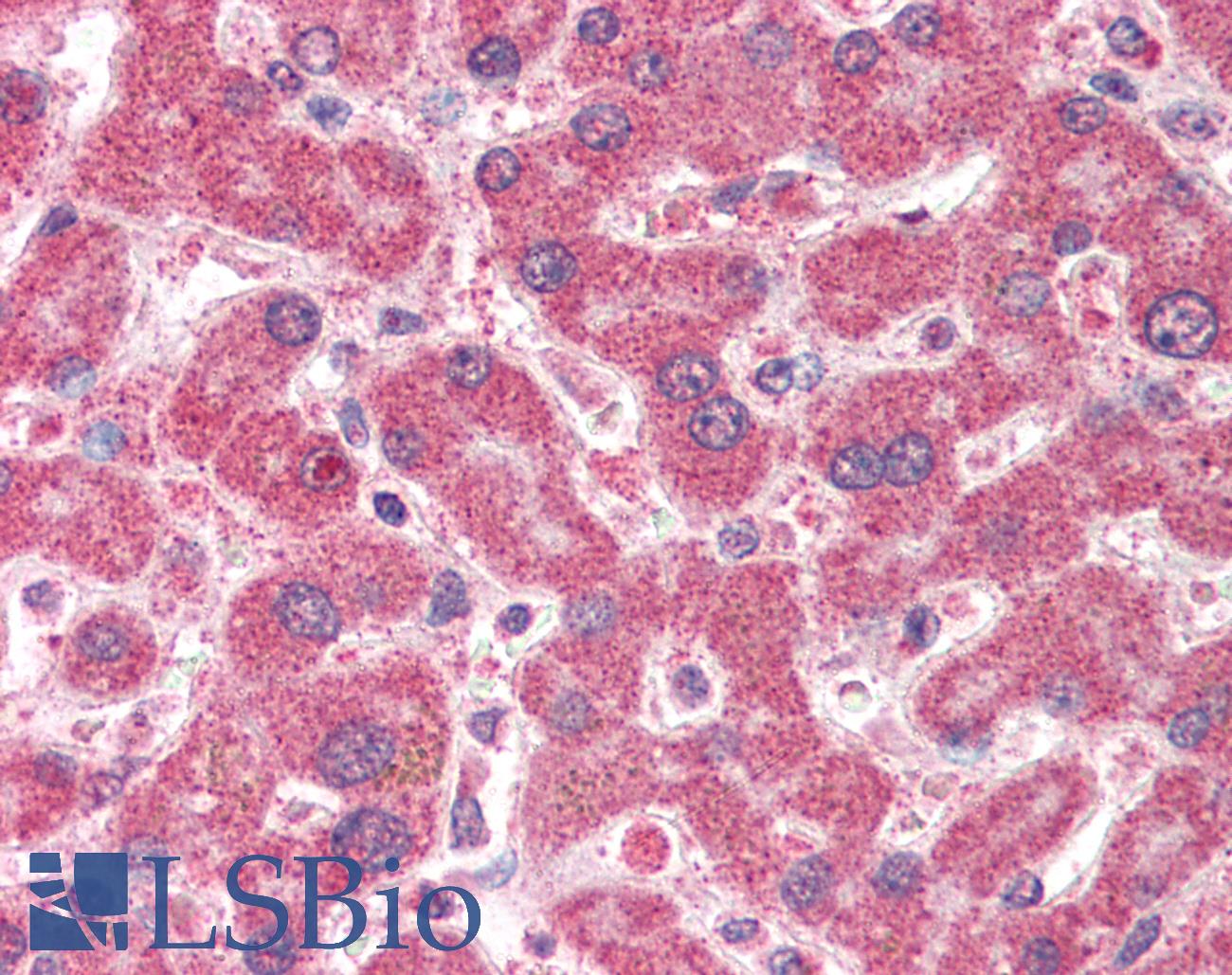 IFT74 / CCDC2 Antibody - Anti-IFT74 antibody IHC of human liver. Immunohistochemistry of formalin-fixed, paraffin-embedded tissue after heat-induced antigen retrieval. Antibody concentration 5 ug/ml.