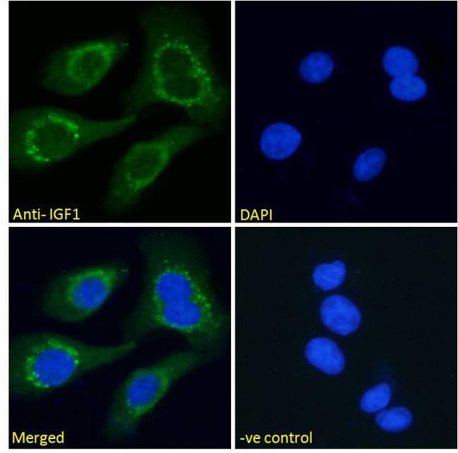 IGF1 Antibody - IGF1 Antibody Immunofluorescence analysis of paraformaldehyde fixed HEK293 cells, permeabilized with 0.15% Triton. Primary incubation 1hr (10ug/ml) followed by Alexa Fluor 488 secondary antibody (2ug/ml), showing cytoplasmic staining. The nuclear stain is DAPI (blue). Negative control: Unimmunized goat IgG (10ug/ml) followed by Alexa Fluor 488 secondary antibody (2ug/ml).