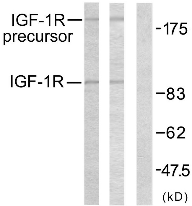 IGF1R / IGF1 Receptor Antibody - Western blot analysis of lysates from 293 cells, treated with Insulin, using IGF1R Antibody. The lane on the right is blocked with the synthesized peptide.