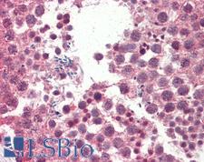 IGFBP1 Antibody - Anti-IGFBP1 antibody IHC staining of human testis. Immunohistochemistry of formalin-fixed, paraffin-embedded tissue after heat-induced antigen retrieval. Antibody concentration 5 ug/ml.