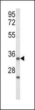 IGFBP2 / IGF-BP53 Antibody - Western blot of IGFBP2 Antibody in Jurkat cell line lysates (35 ug/lane). IGFBP2 (arrow) was detected using the purified antibody.(2 ug/ml)