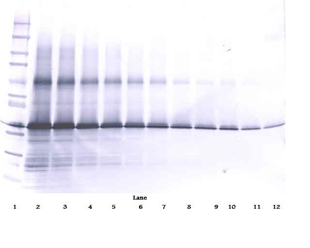 IGFBP3 Antibody - Western Blot (non-reducing) of IGFBP3 antibody