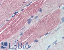 IGFBP6 Antibody - Anti-IGFBP6 antibody IHC of human skeletal muscle. Immunohistochemistry of formalin-fixed, paraffin-embedded tissue after heat-induced antigen retrieval. Antibody concentration 5 ug/ml.