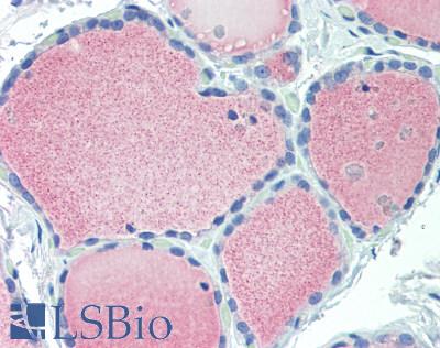 IGFBP6 Antibody - Human Thyroid: Formalin-Fixed, Paraffin-Embedded (FFPE)
