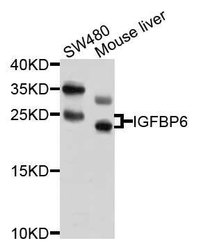 IGFBP6 Antibody - Western blot analysis of extracts of various cell lines, using IGFBP6 antibody at 1:1000 dilution. The secondary antibody used was an HRP Goat Anti-Rabbit IgG (H+L) at 1:10000 dilution. Lysates were loaded 25ug per lane and 3% nonfat dry milk in TBST was used for blocking. An ECL Kit was used for detection and the exposure time was 15s.