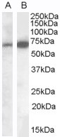 IGSF4C / CADM4 Antibody - IGSF4C / CADM4 antibody staining of Human Brain (Cerebellum) lysate (35ug protein in RIPA buffer). A) EB08040 (0.1ug/ml) and B) IGSF4C / CADM4 antibody (0.05ug/ml). Detected by chemiluminescence.